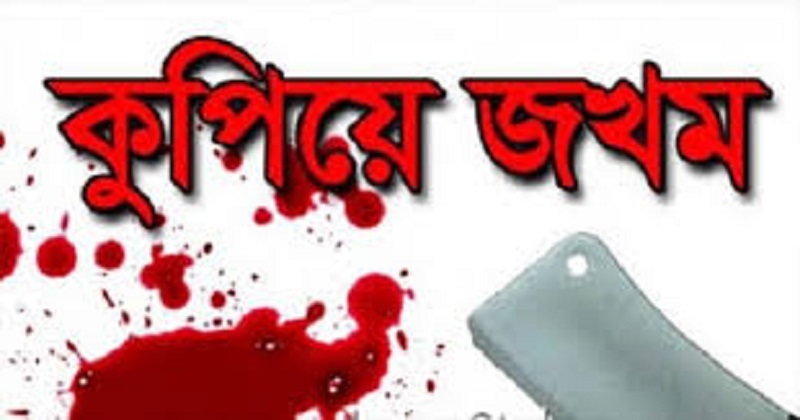 চাঁপাইনবাবগঞ্জে বৈদ্যূতিক খুঁটিতে বেঁধে যুবককে কুপিয়ে জখম,আটক ২